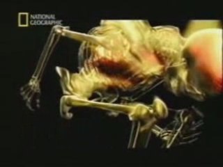 Resistencia a fuerzas G