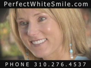 Cosmetic Dentist in Los Angeles, California, Teeth Whitening