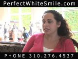 Lumineers in Beverly Hills California, Porcelain Veneers CA