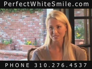 Lumineers in Beverly Hills California, Porcelain Veneers CA