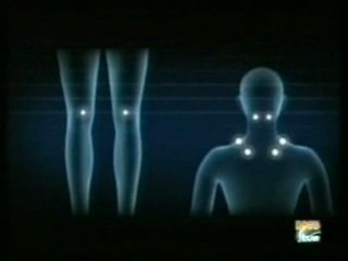 Fibromialgia: Sintomas y diagnostico