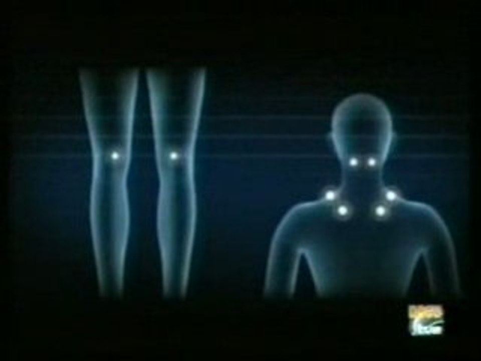 Fibromialgia: Sintomas y diagnostico