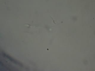 Espermatozoide en vivo