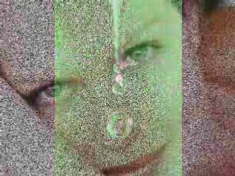 Galvanic Facials Treatments in San Diego