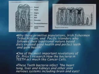 severe gum disease,gum disease antibiotics in Los Angeles