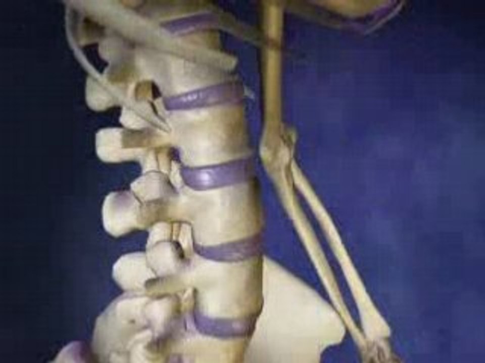 Spine Injury