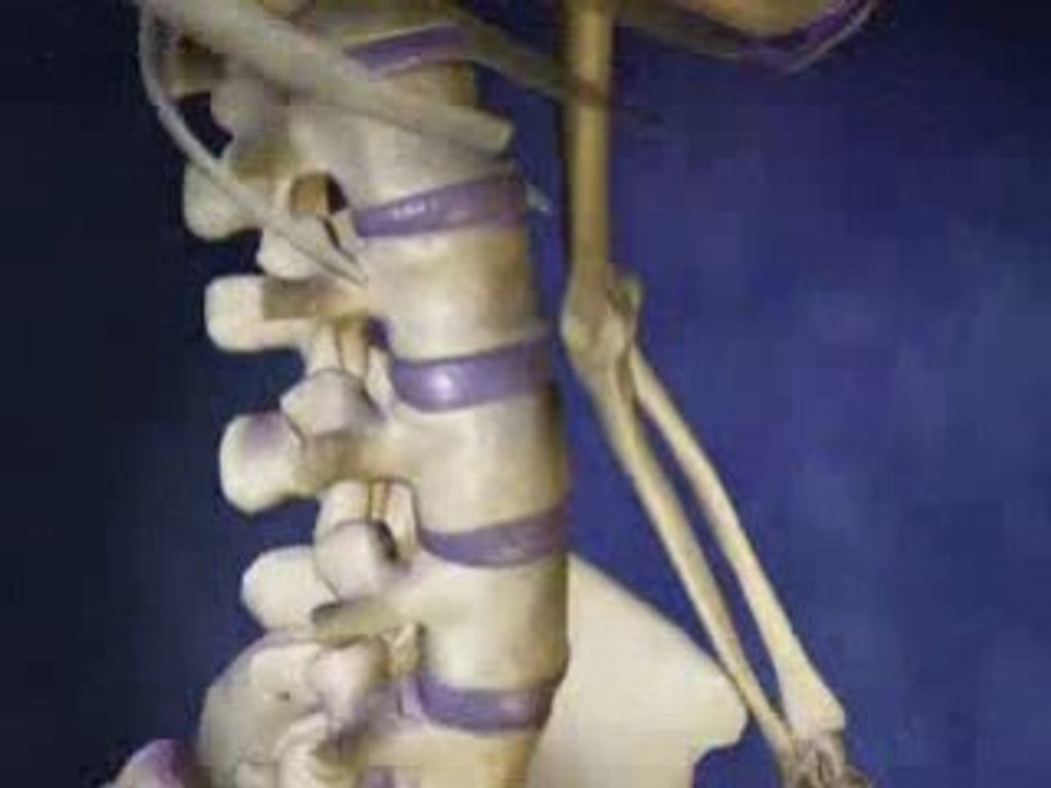 Spine Fracture