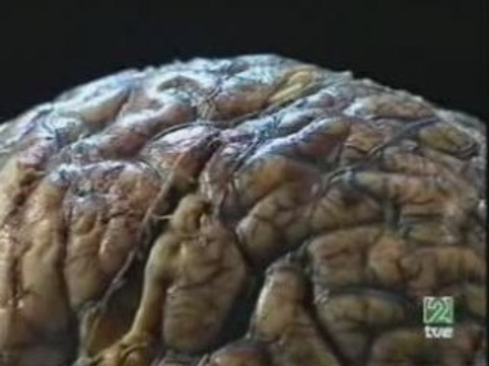 Esquizofrenia: Hipotesis multicausal