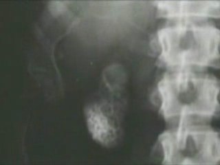 Vintage Scientific X-Ray History and Applications