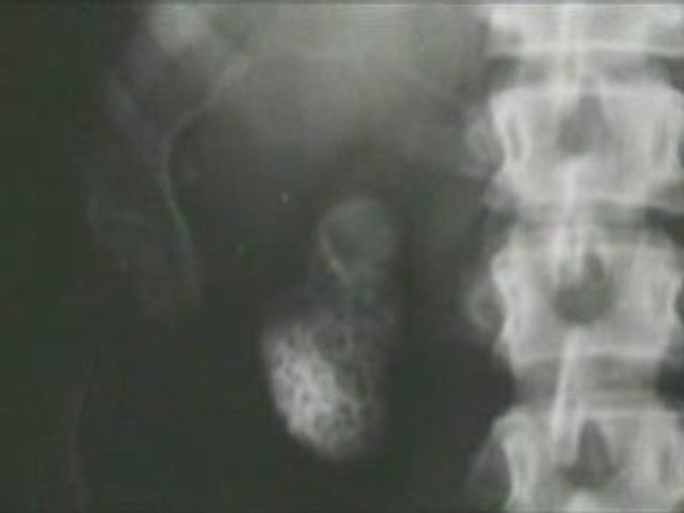 Vintage Scientific X-Ray History and Applications