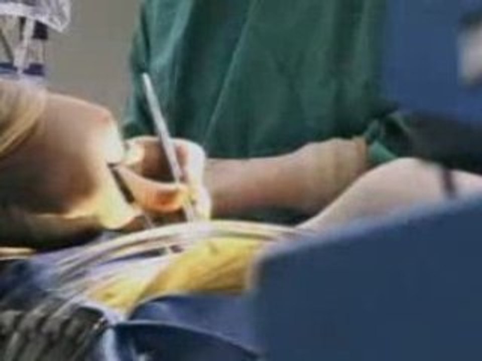 Heart Transplant Surgery
