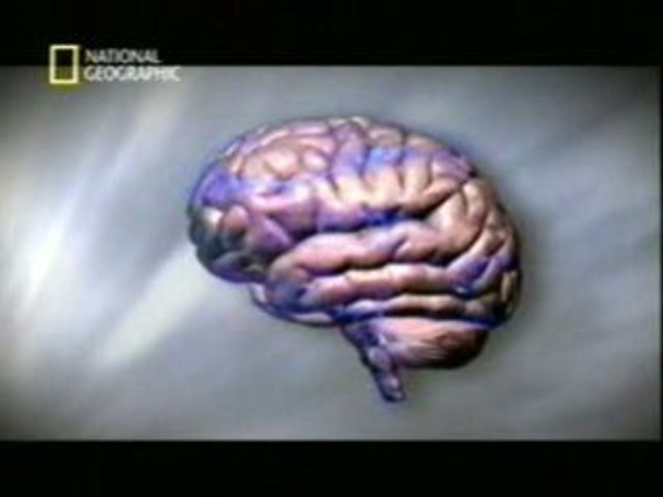 Sonambulismo