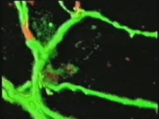 Cerebro: Redes neurales