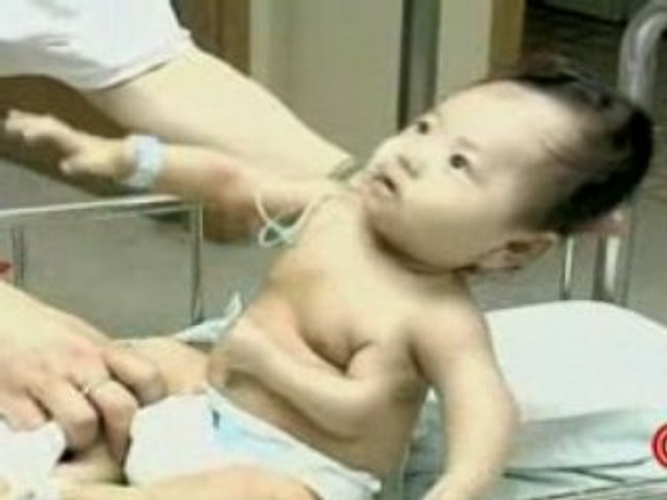 Un bébé a 3 bras