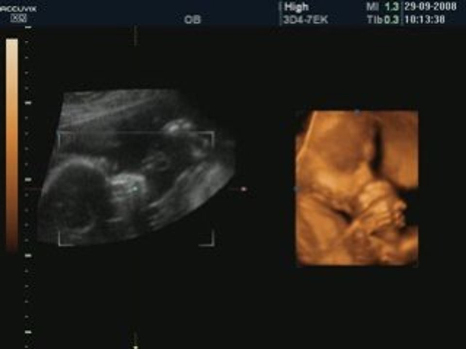 BABY_10_LIVE