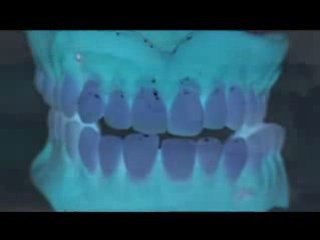 La puce RFID fait ses dents