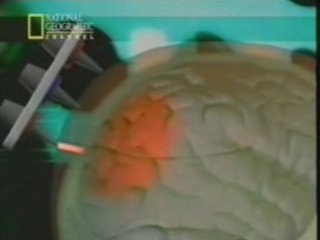 Topografia optica y plasticidad cerebral: Dr. Kogure