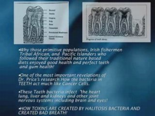 to cure bad breath,eliminate bad breath in Los Angeles