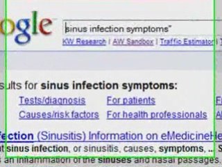 Keyword Research LifeCycle Part 3 - Competition