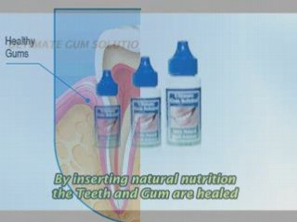 receding gums,gum surgery,gum disease,gum recession