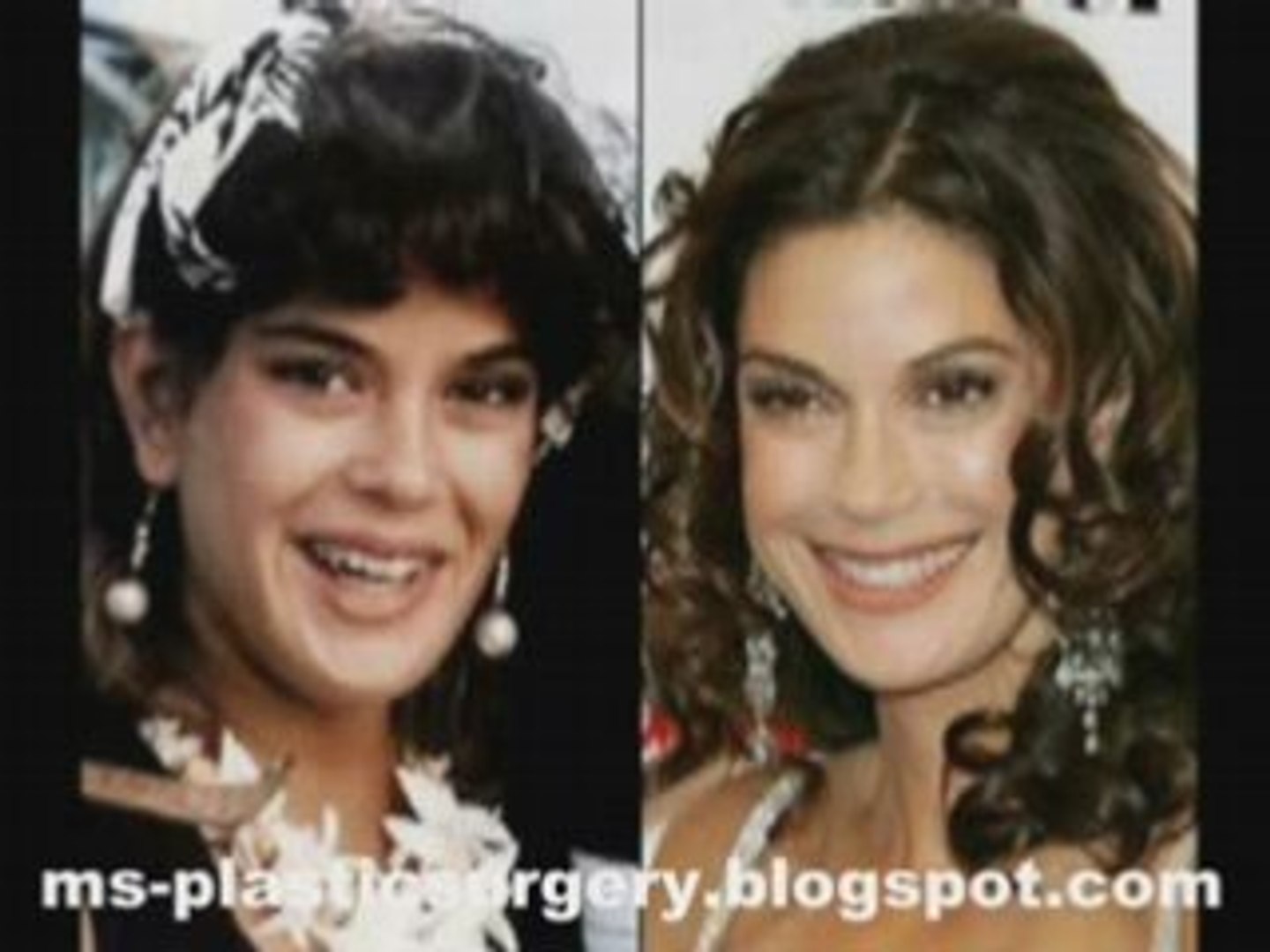 ⁣Hot Celebs plastic surgery # 1