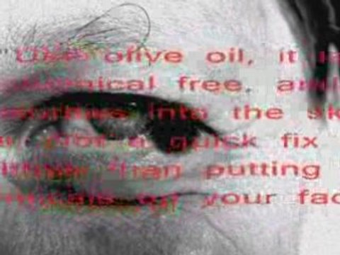 How to Remove Under Eye Wrinkles Without Surgery?