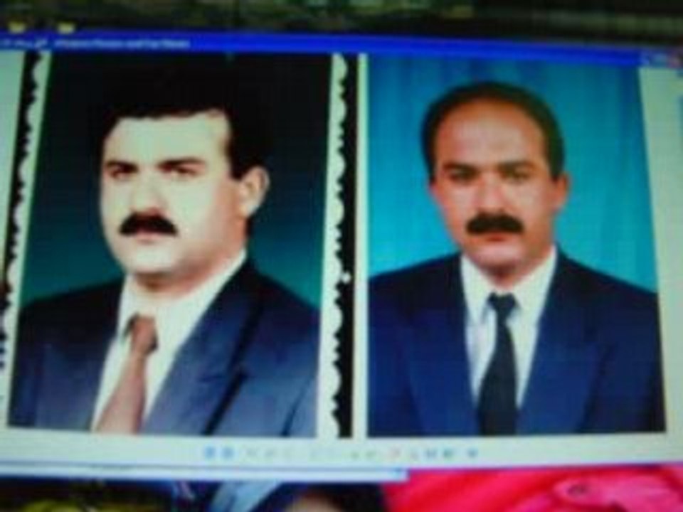 عمليات التجميل-الليزر-تجميل الانف- المنخار-زرع الشعر-قطر-دبي