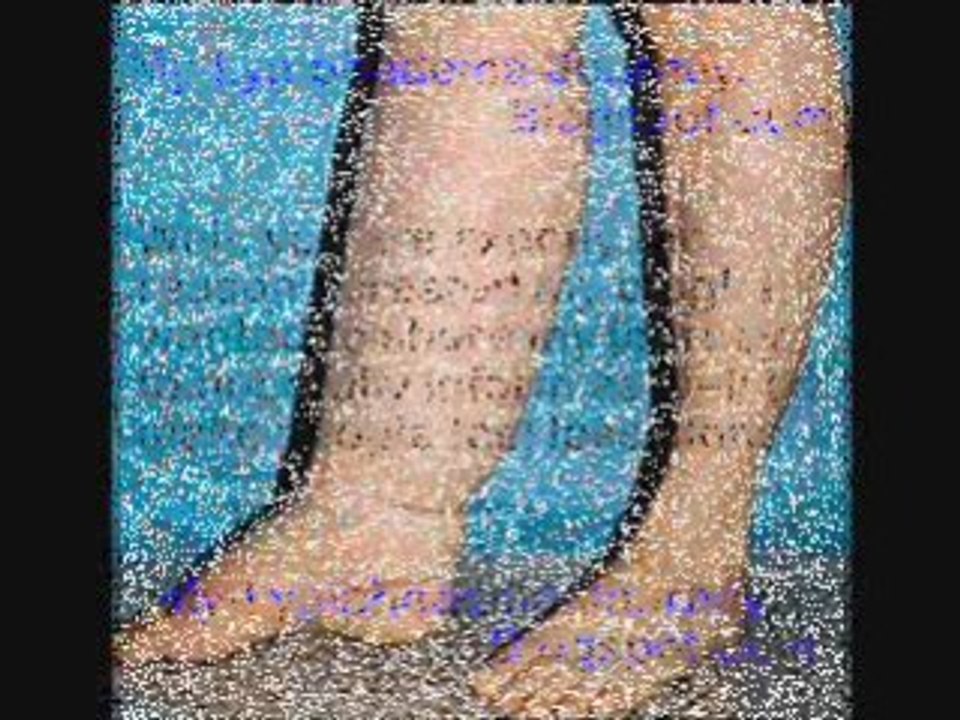 Compression Stockings