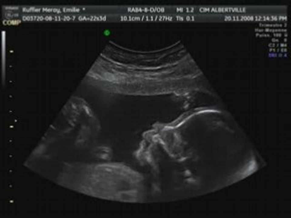 bibou dans le ventre