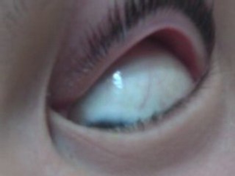 mon oeil!
