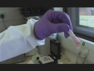 L ORIGINE DU SIDA 3/5