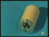 Capsula endoscopica (La videopildora)