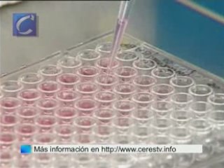 Hoy, lunes, se celebra el Día mundial contra el Sida