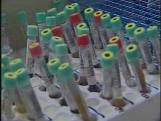 ACP Recommends Routine HIV Screening for All