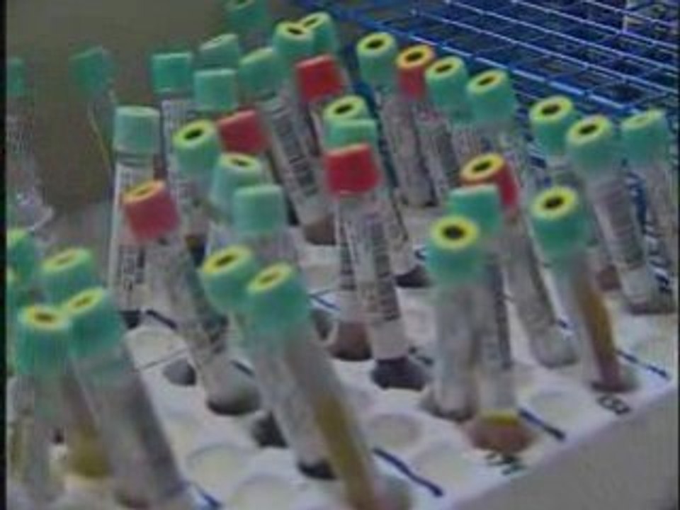ACP Recommends Routine HIV Screening for All
