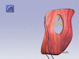 Un paciente con parálisis facial recupera la sonrisa tras...