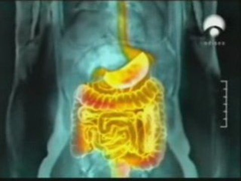 Fibra alimentaria y transito intestinal