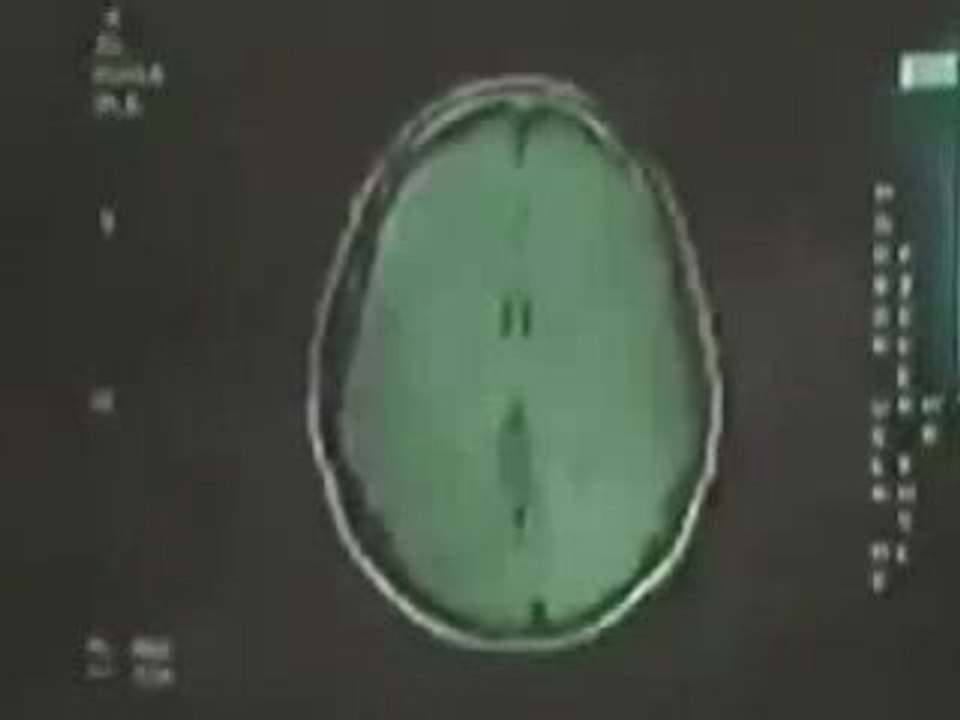 Mind_control_turn_off_your_tv