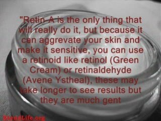 Best Eye Cream Fine Lines