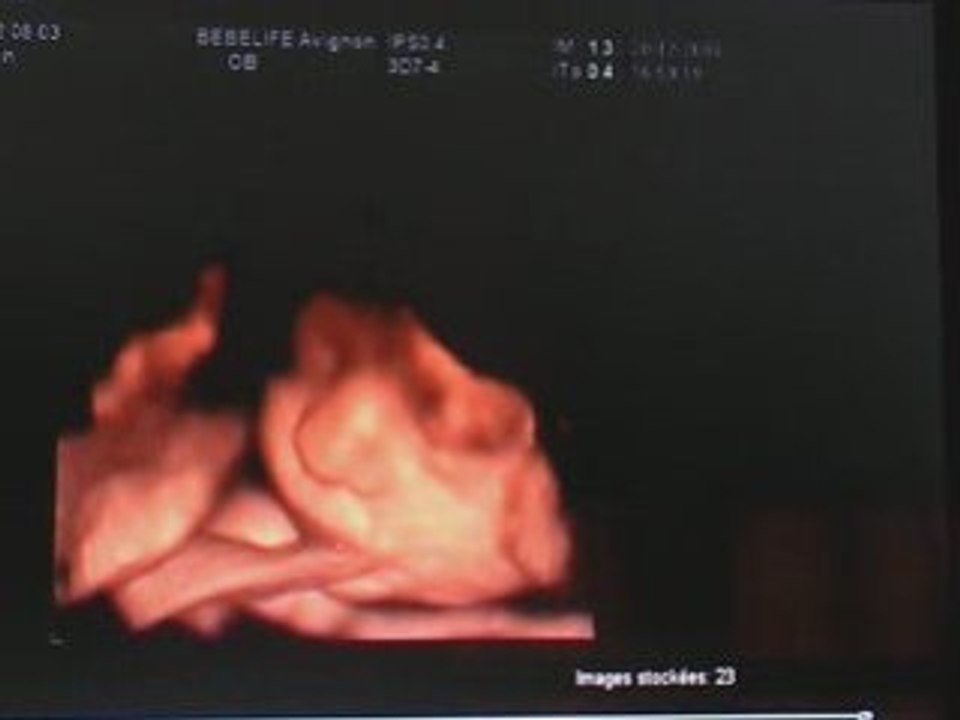 Johan en 3D PARTIE 2
