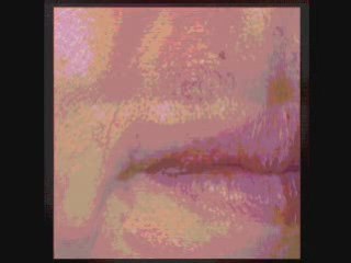 Angular Cheilitis Treatment