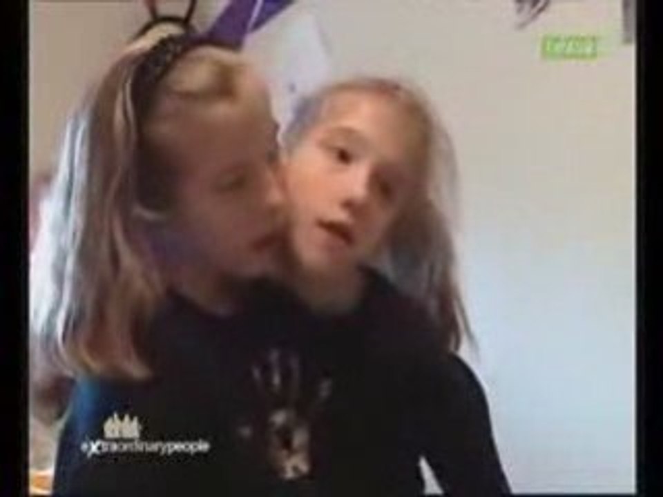 soeurs siamoises 2/5