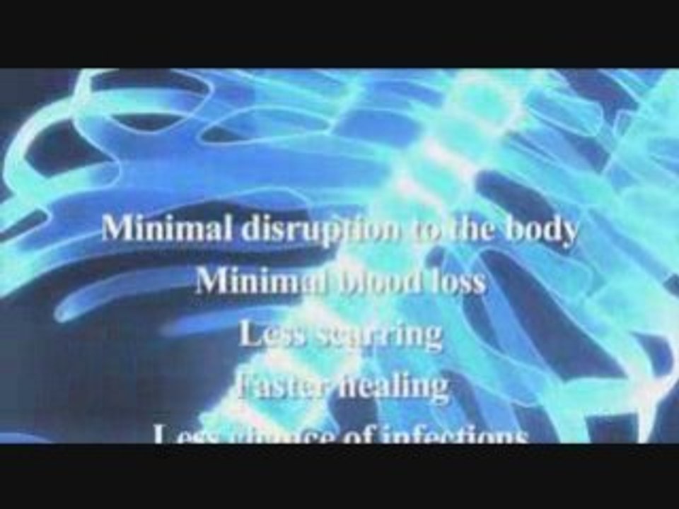Cervical spinal surgery