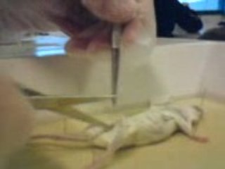 Dissection SVT(part2)