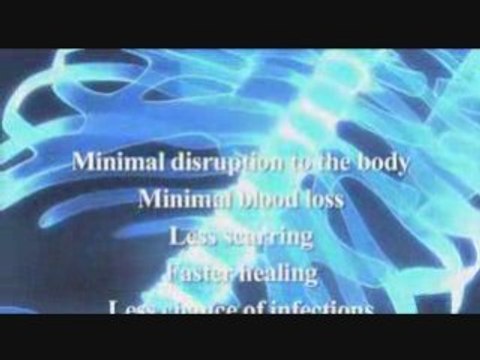 Herniated disc exercises