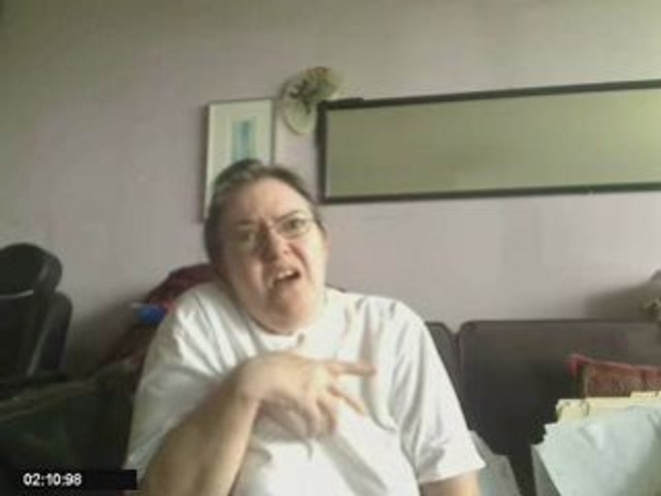 Tardive Dyskensia, Progressive dystonia  from antidepressant