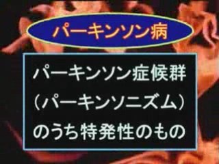 Parkinson disease in Japanese