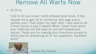 “ Treatment for Warts”