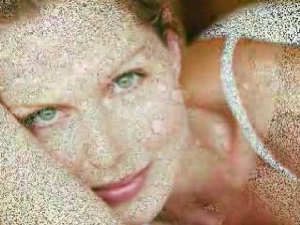 Juvaderm Radiesse and Botox Wrinkle Treatments in Point Loma