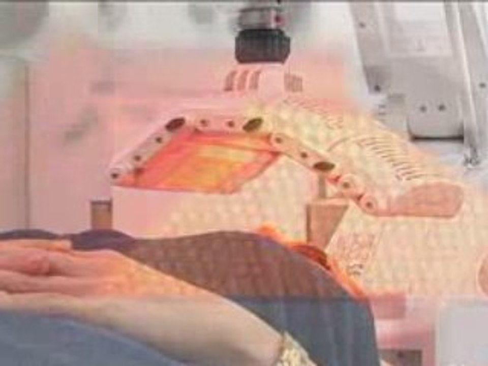 Photo Skin Regeneration Brisbane